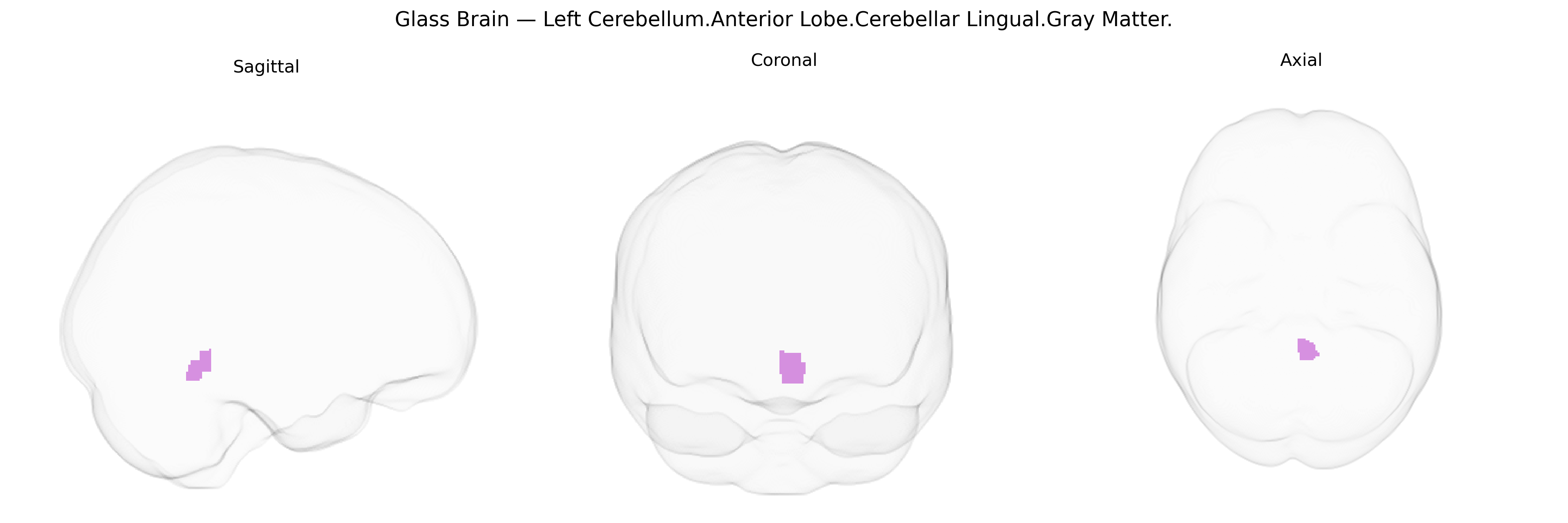 Triplanar Ghost Brain