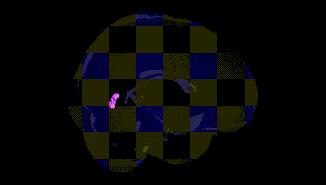 Full Brain Black