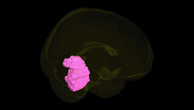 Full Brain Black