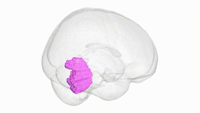 Full Brain White