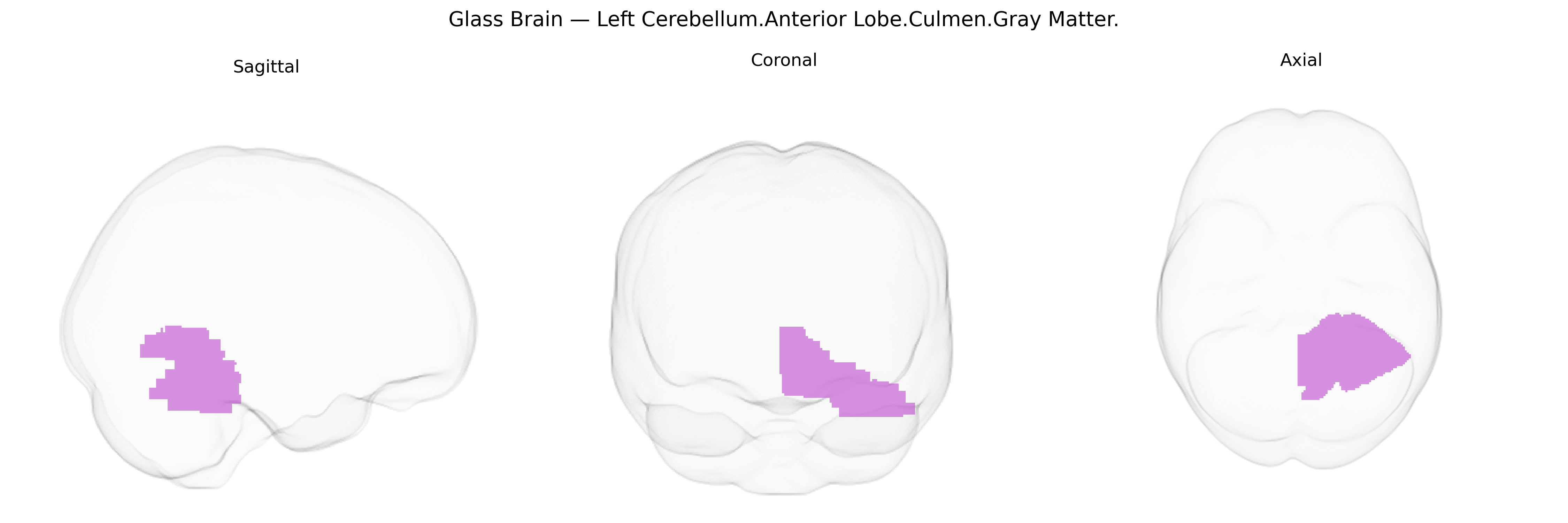Triplanar Ghost Brain