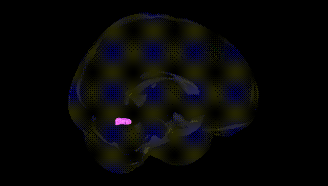 Full Brain Black