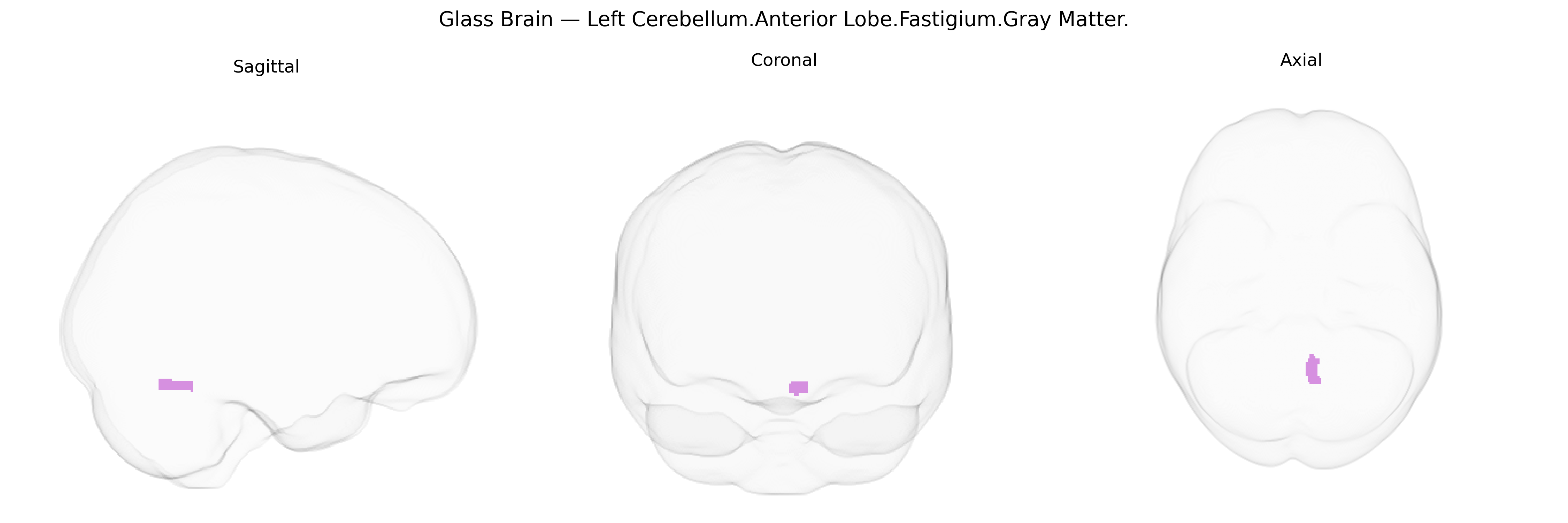 Triplanar Ghost Brain