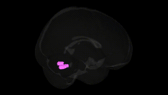 Full Brain Black
