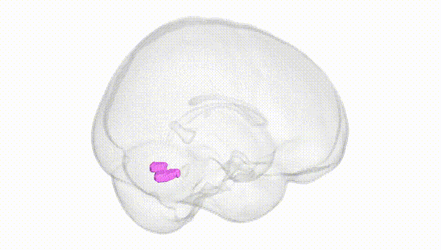 Full Brain White