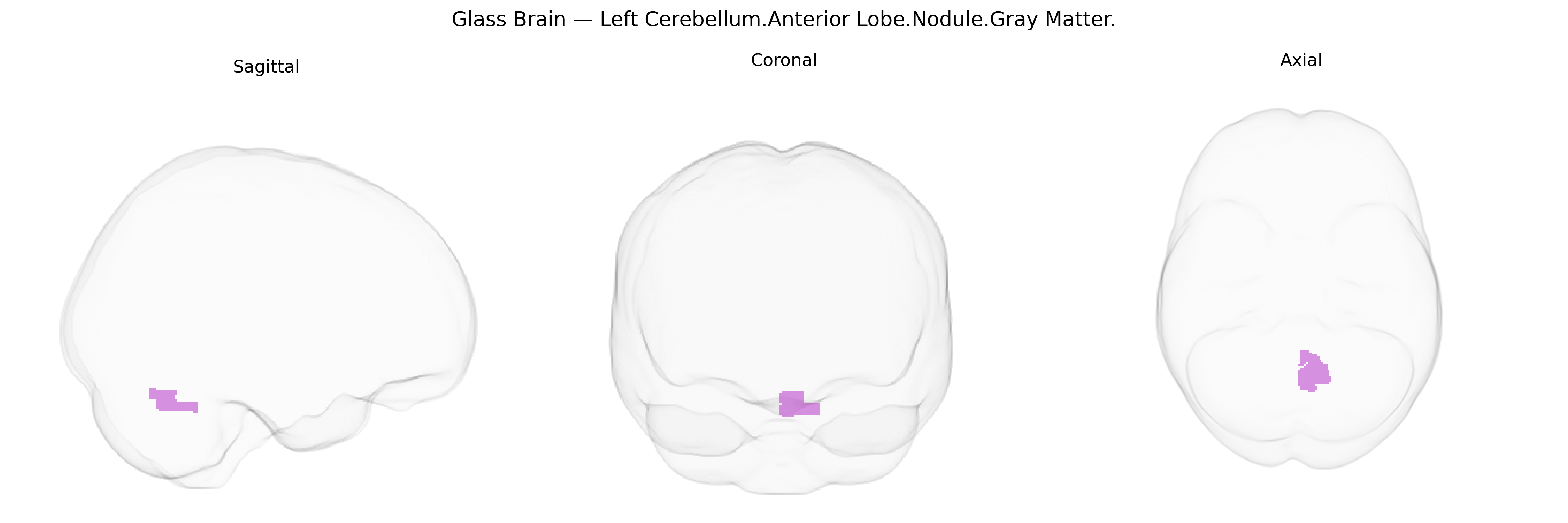 Triplanar Ghost Brain