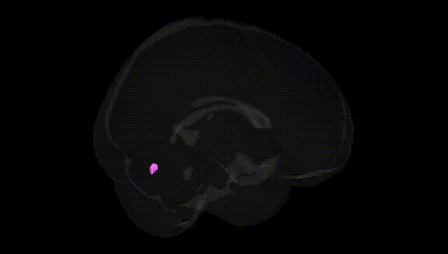 Full Brain Black