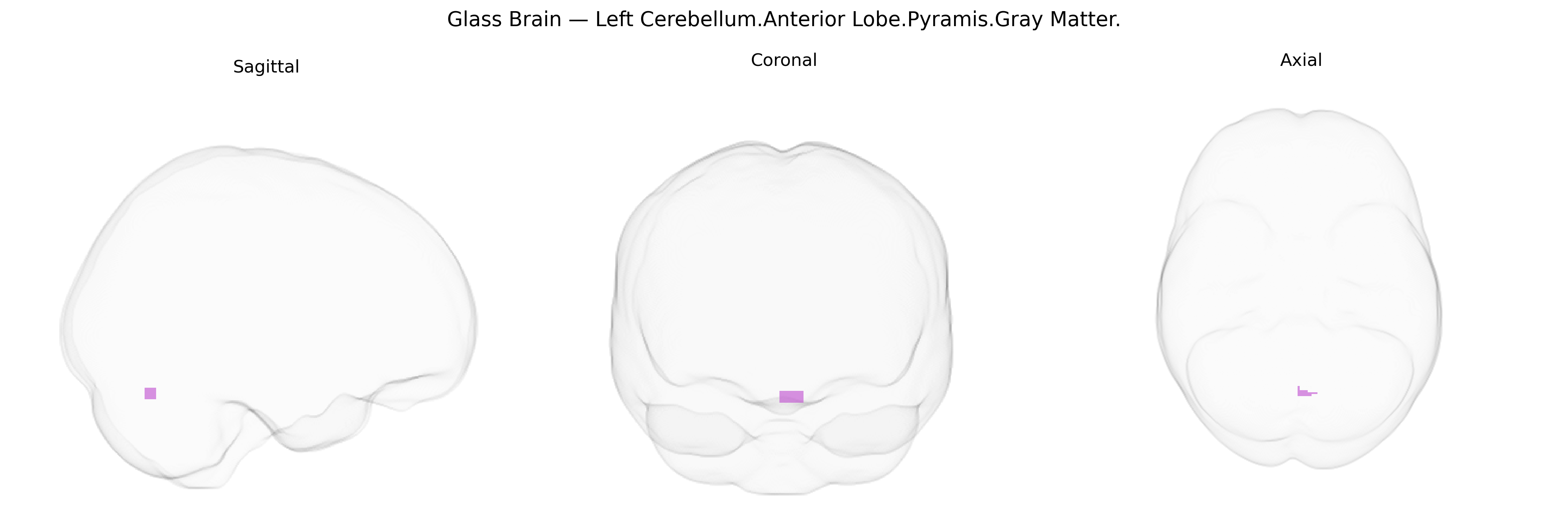 Triplanar Ghost Brain