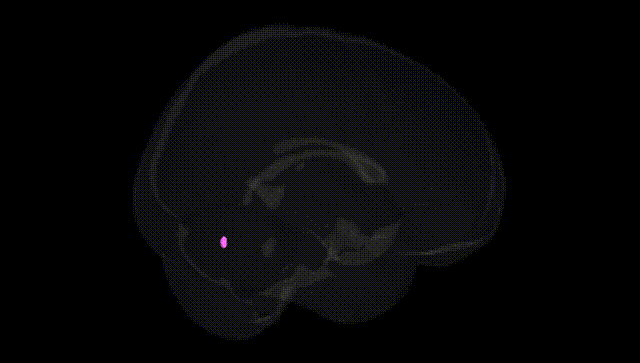 Full Brain Black