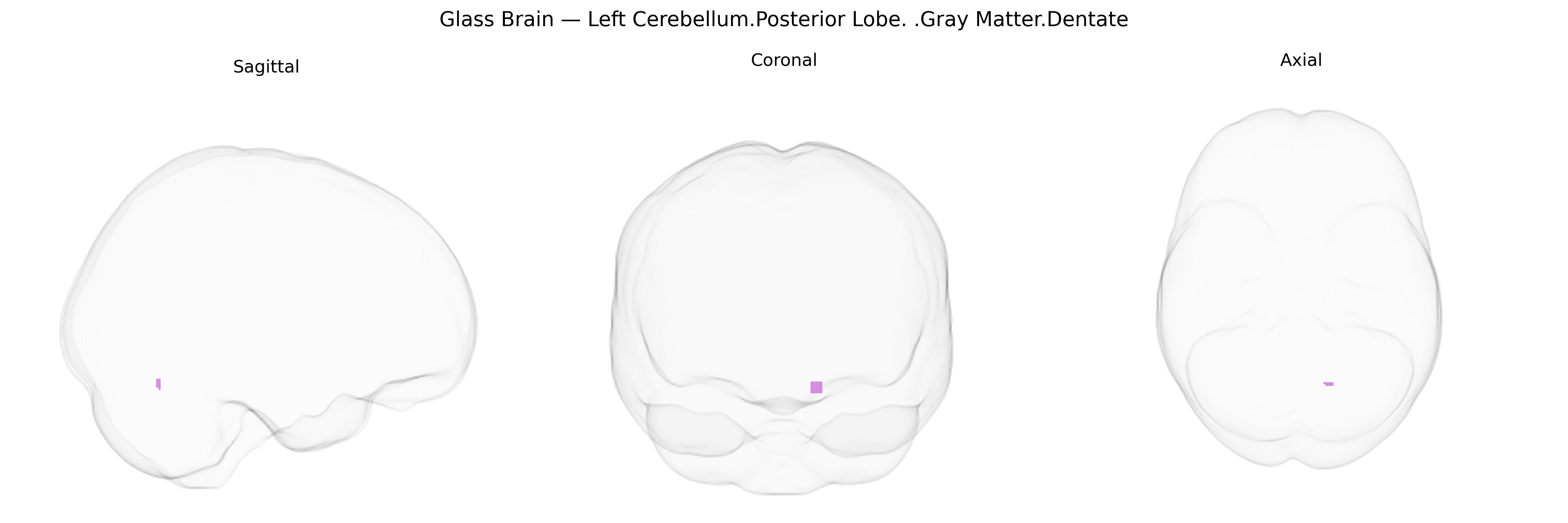 Triplanar Ghost Brain