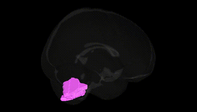 Full Brain Black