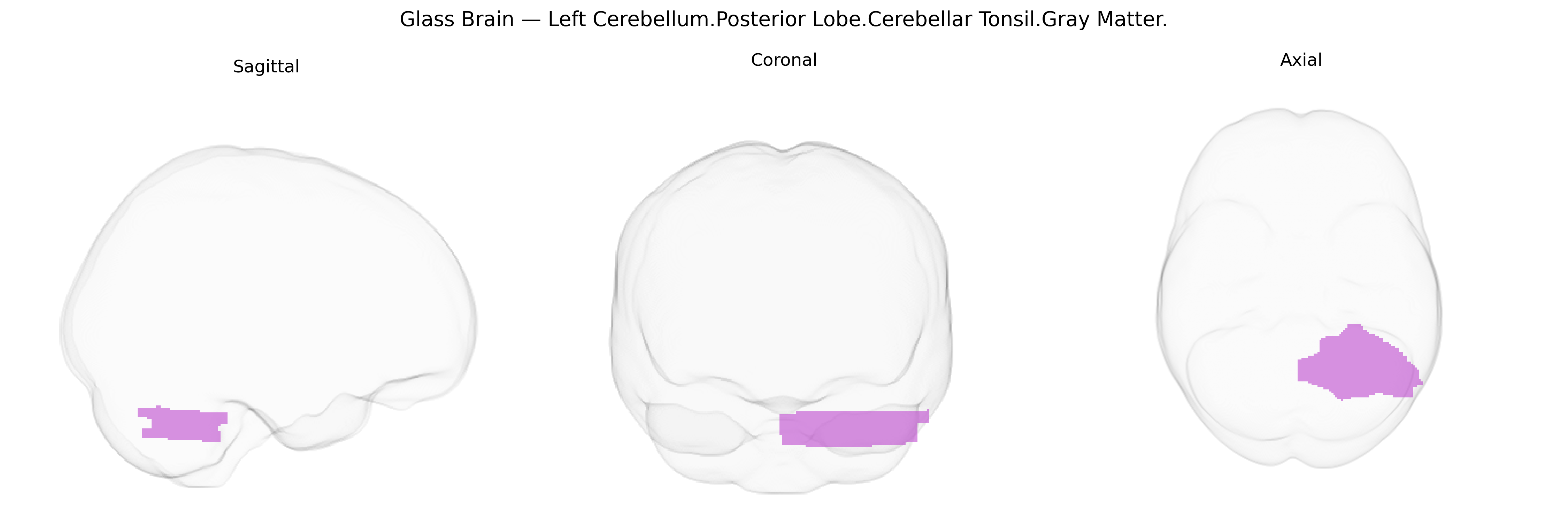 Triplanar Ghost Brain