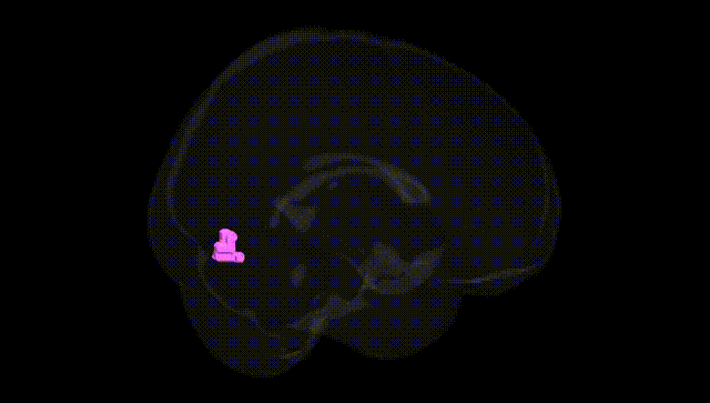 Full Brain Black