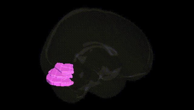 Full Brain Black