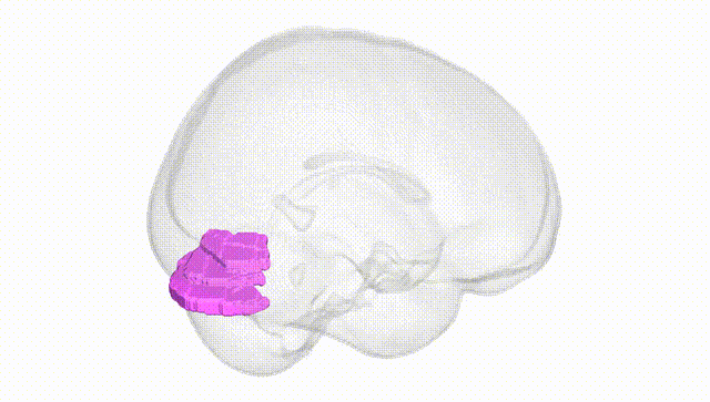 Full Brain White