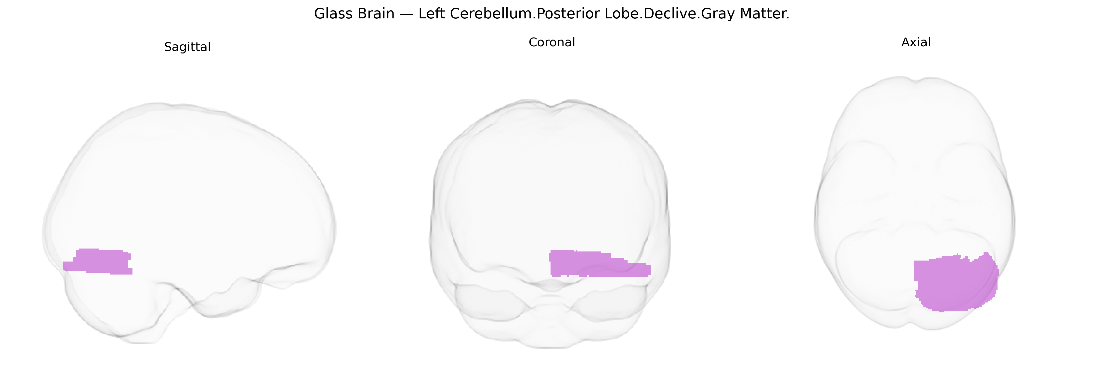 Triplanar Ghost Brain
