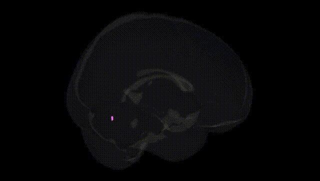 Full Brain Black
