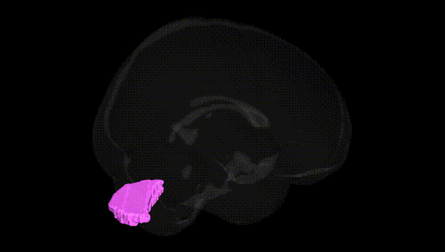 Full Brain Black