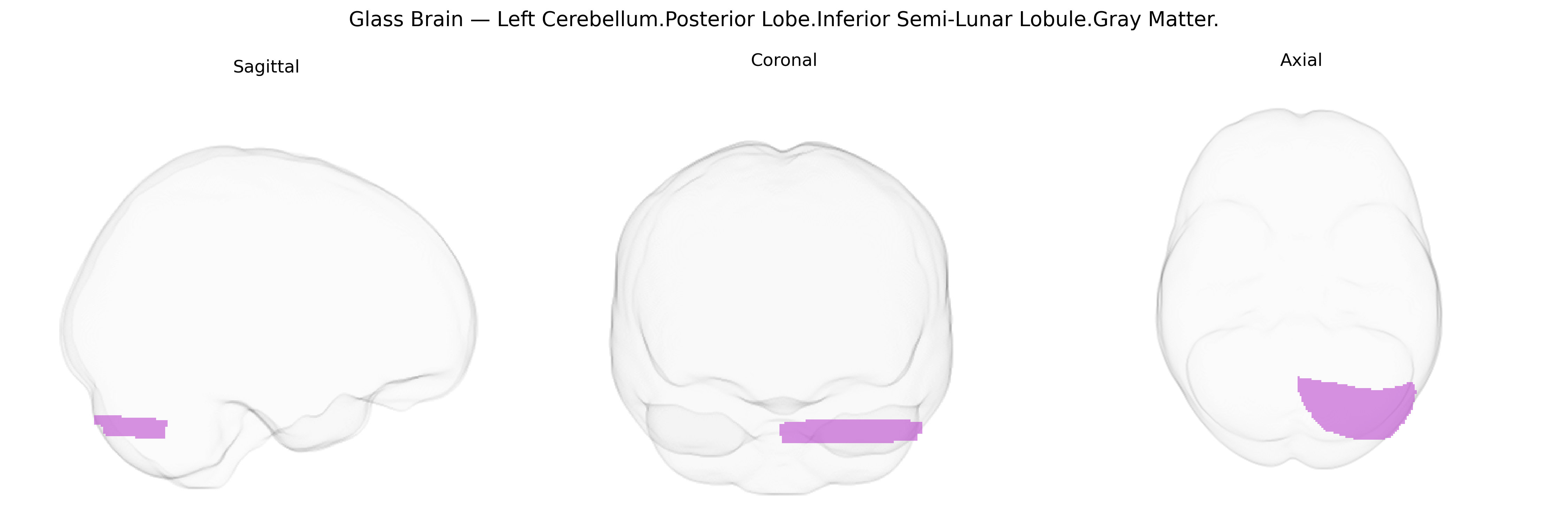 Triplanar Ghost Brain