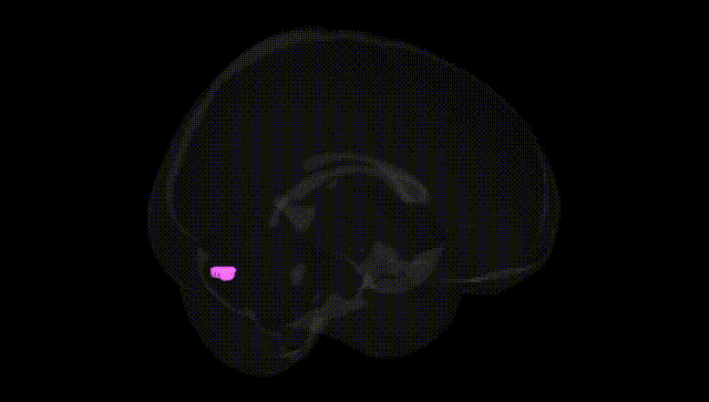 Full Brain Black
