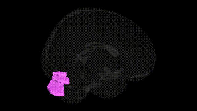 Full Brain Black