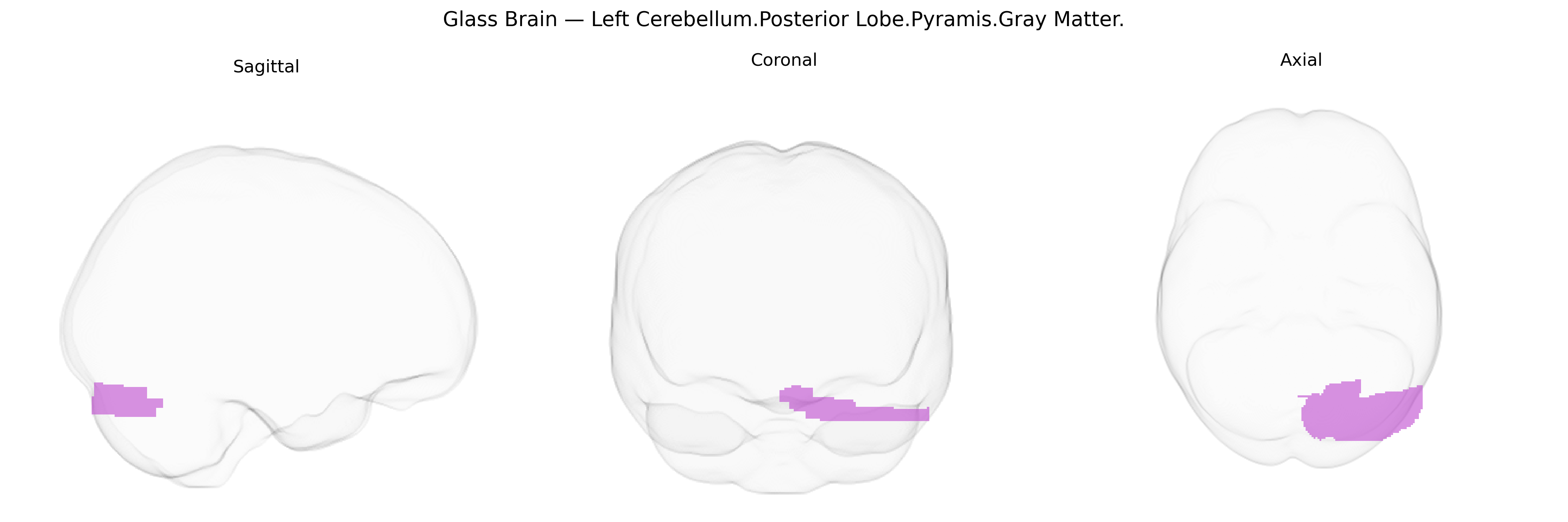 Triplanar Ghost Brain