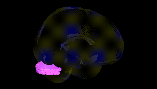 Full Brain Black