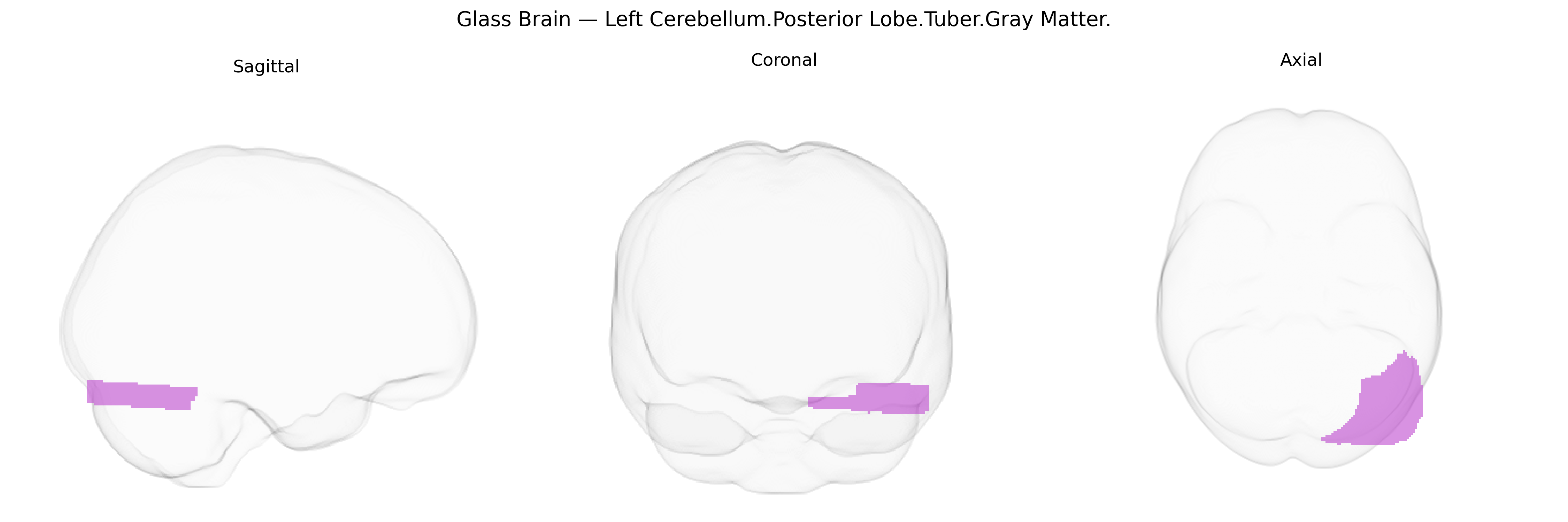 Triplanar Ghost Brain