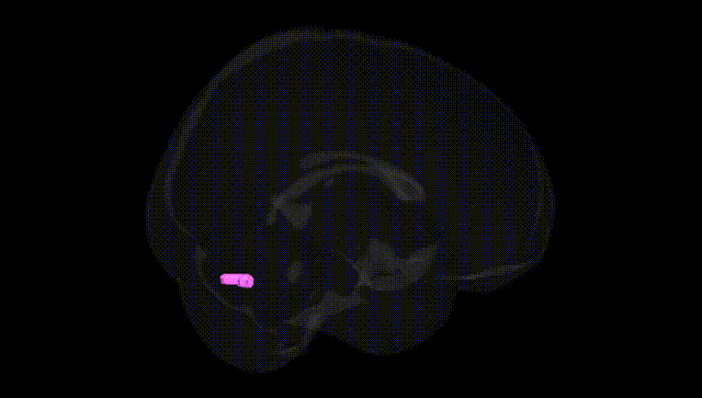 Full Brain Black