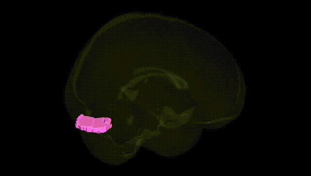 Full Brain Black
