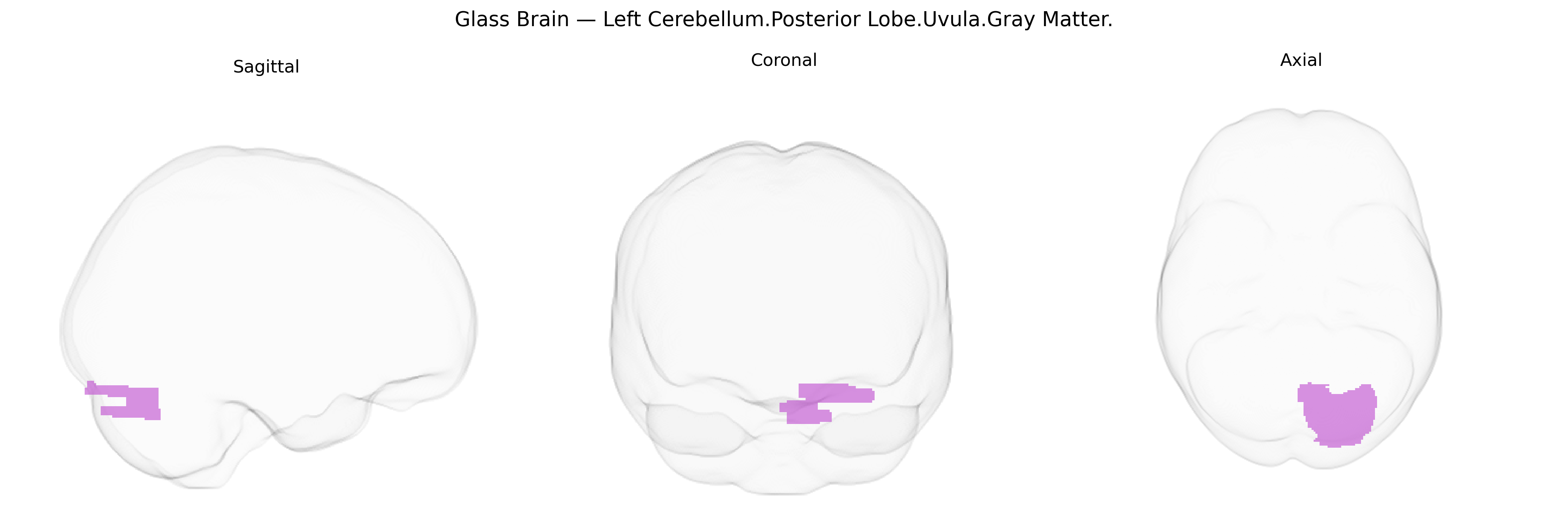 Triplanar Ghost Brain