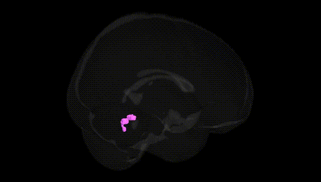 Full Brain Black