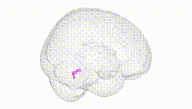 Full Brain White