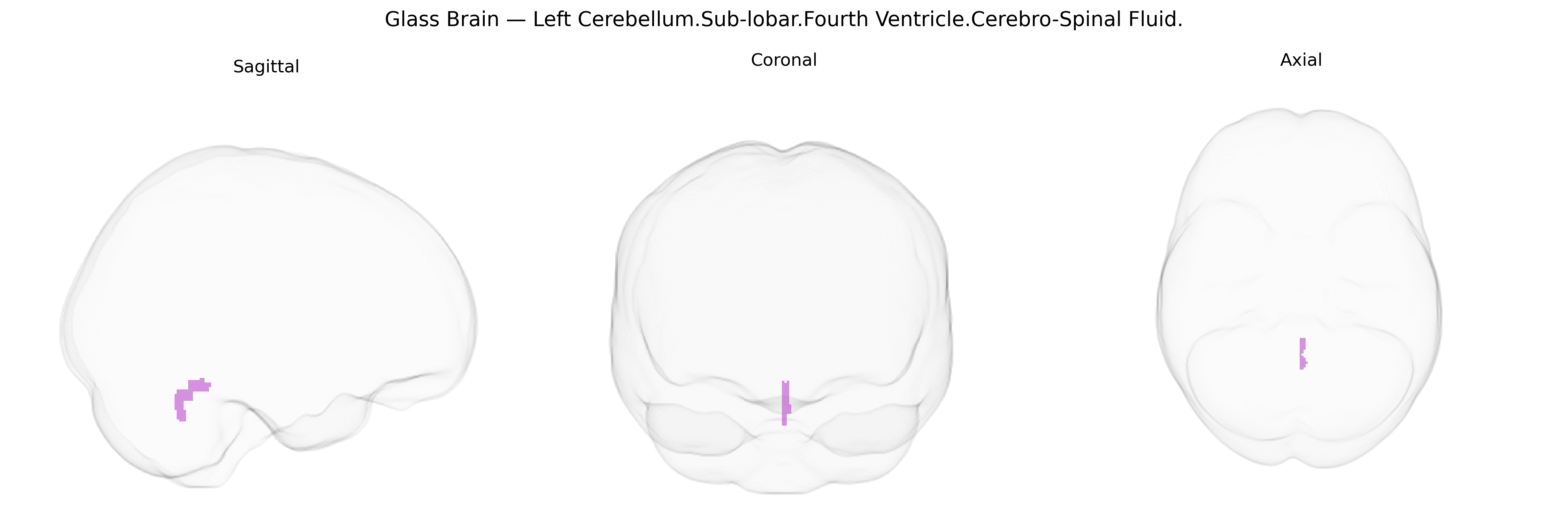 Triplanar Ghost Brain