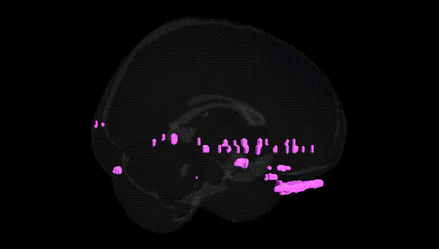 Full Brain Black