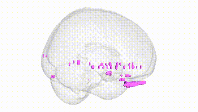 Full Brain White