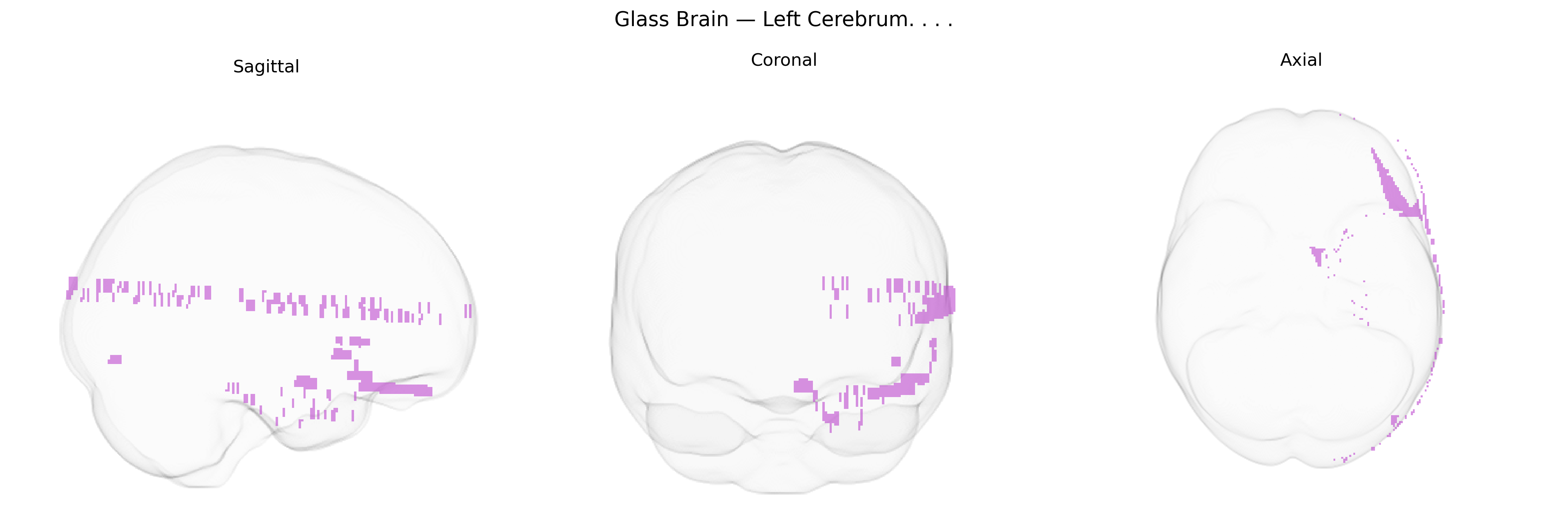 Triplanar Ghost Brain