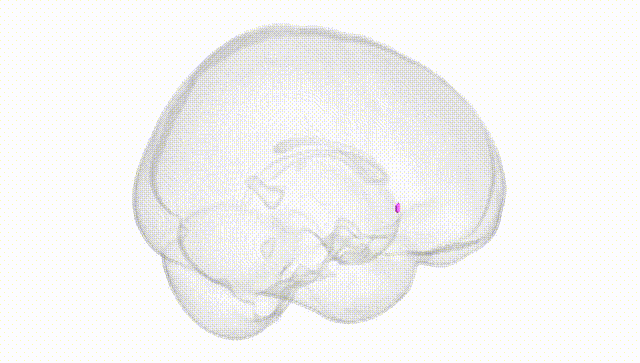 Full Brain White
