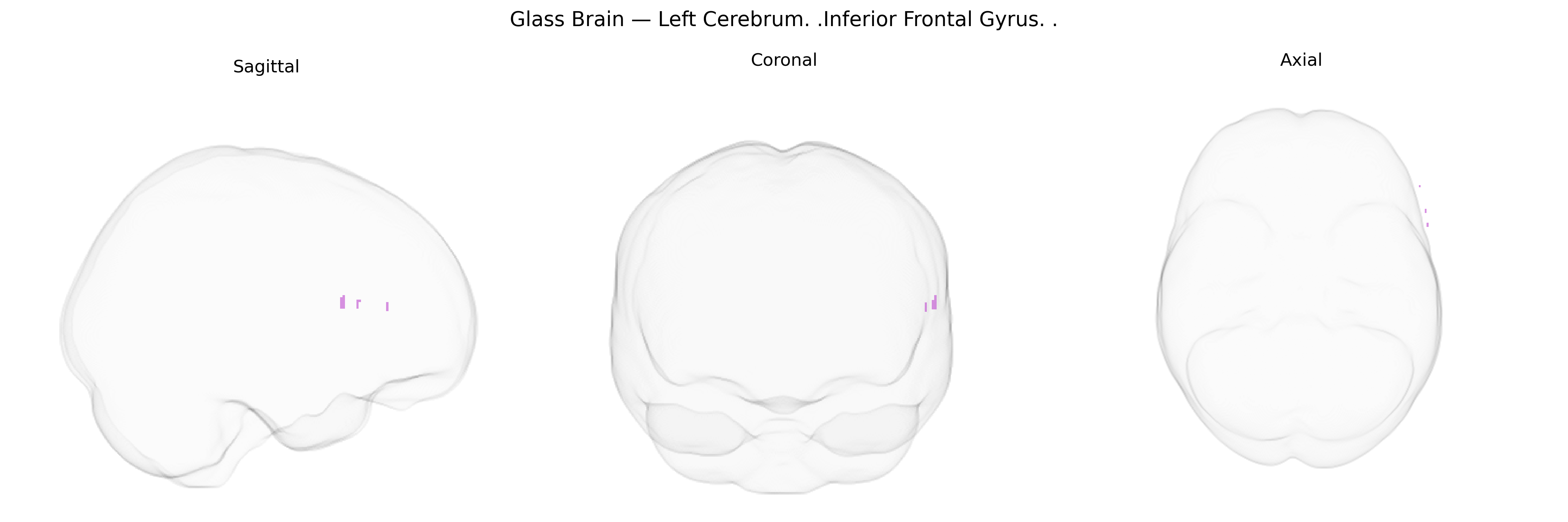 Triplanar Ghost Brain