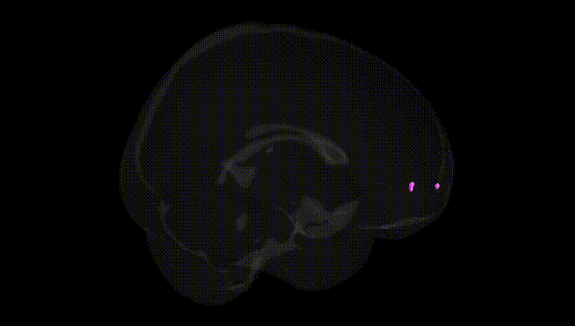 Full Brain Black