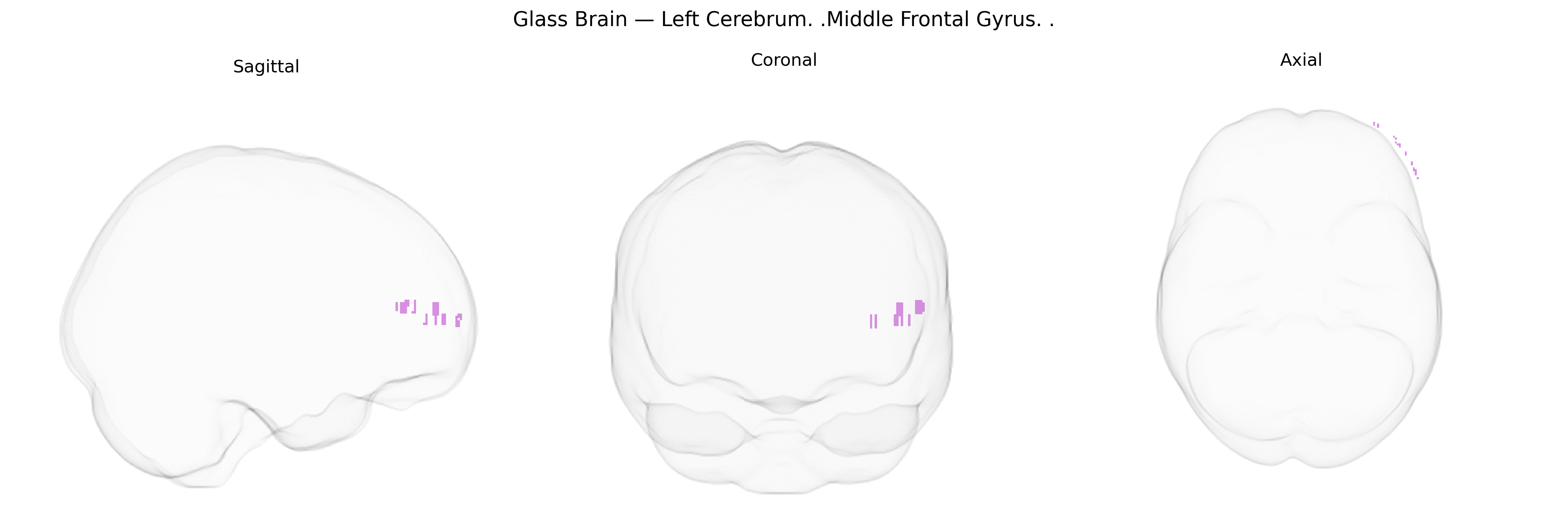 Triplanar Ghost Brain