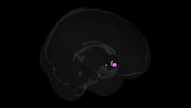 Full Brain Black