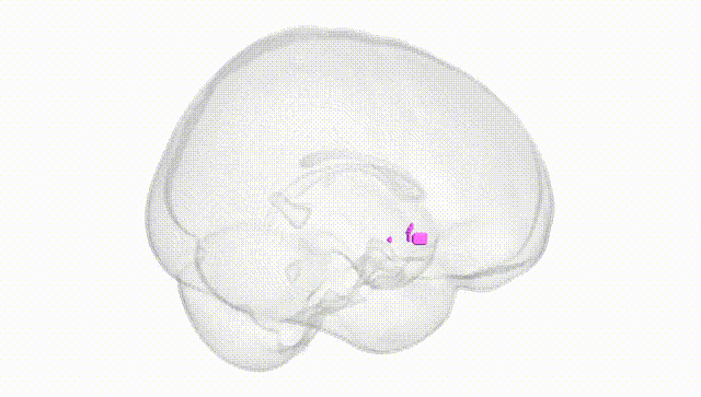 Full Brain White