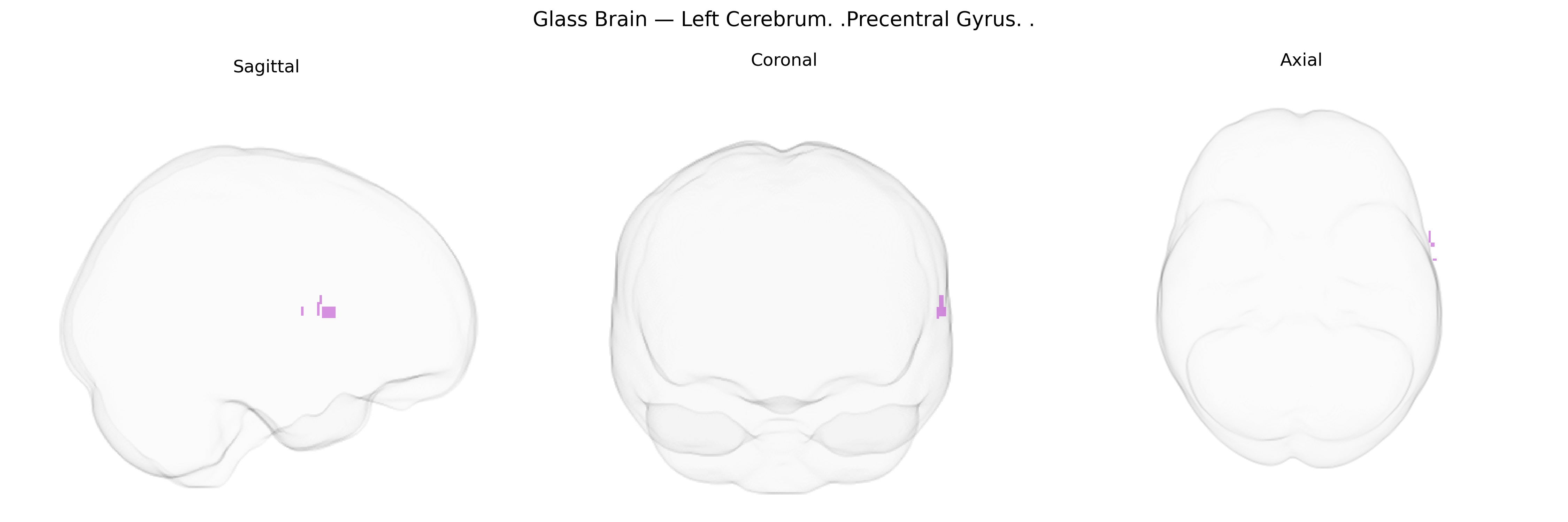 Triplanar Ghost Brain