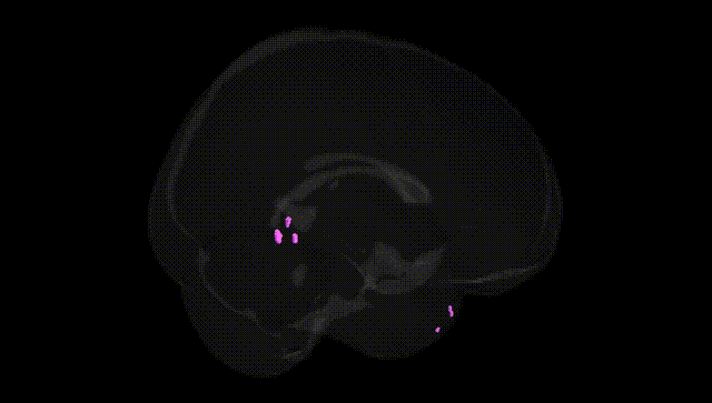 Full Brain Black