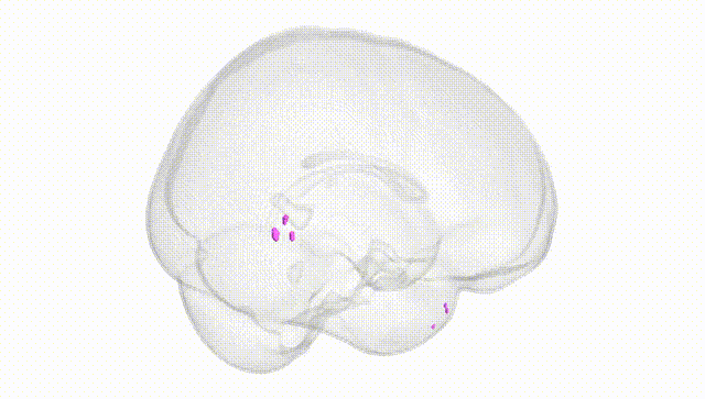 Full Brain White