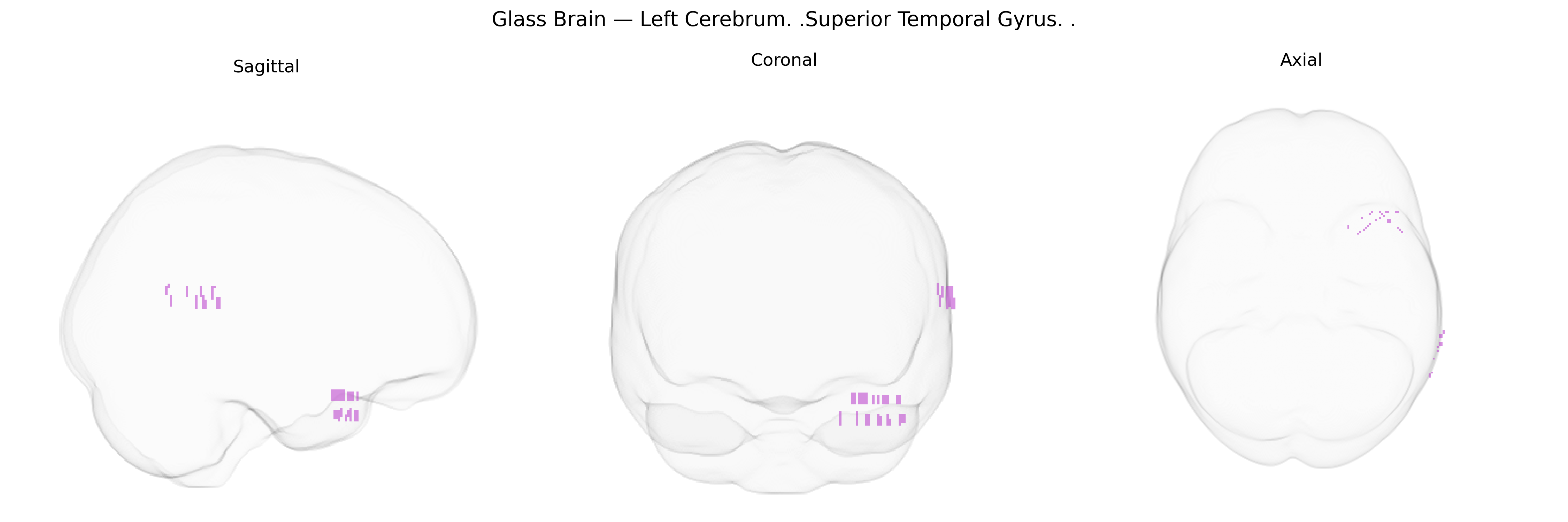 Triplanar Ghost Brain