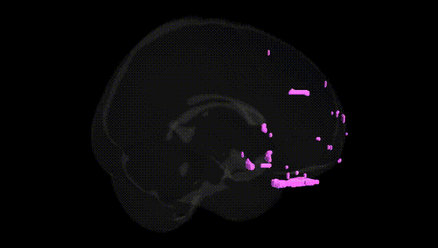 Full Brain Black