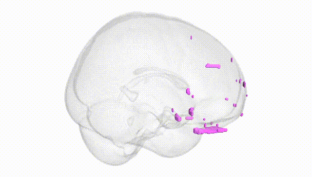 Full Brain White