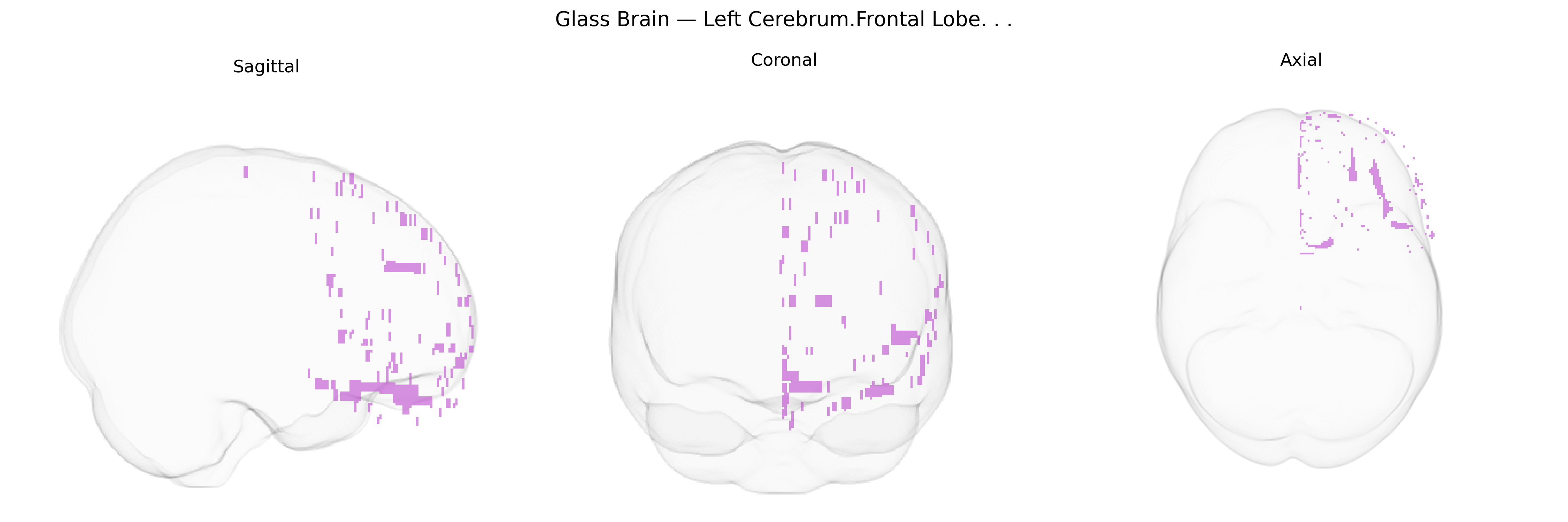 Triplanar Ghost Brain